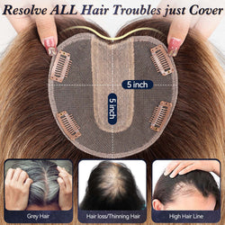 Image of starluck 5x5 inch Lage Silk Base 14 Inch Real Human Hair Toppers for Women,60 Gram High volume, 100% Real Human Hair Toppers for Women with thinning hair hair loss. no Bangs